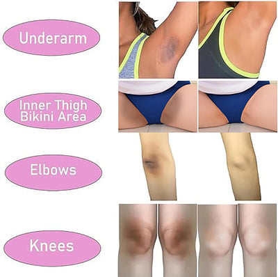 Skin Whitening Cream Bleaching Cream for Body Intimate Area, Private Parts, Underarm, Knees, Elbows, Inner Thigh, Bikini Areas, Bikini Line, Lightening Dark Spot Remover For Intimate Part (1.7FL OZ)
