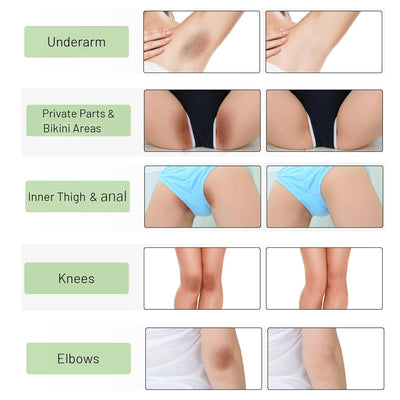 Skin Whitening Cream Bleaching Cream for Body Intimate Area, Private Parts, Underarm, Knees, Elbows, Inner Thigh, Bikini Areas, Bikini Line, Lightening Dark Spot Remover For Intimate Part (1.7FL OZ)